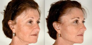 3 pasi simpli pentru un facelift la tine acasa!