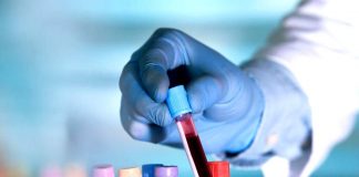 Grupele de sange si predispozitia la infarct