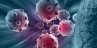 Tumorile fac ravagii in Romania