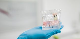 Cat de durabile sunt cu adevarat implanturile dentare?