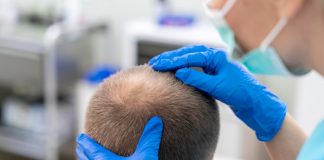 Cea Mai Bună Clinică de Transplant de Păr din Turcia